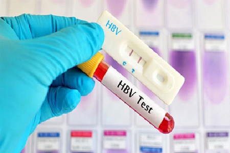 HBV-test